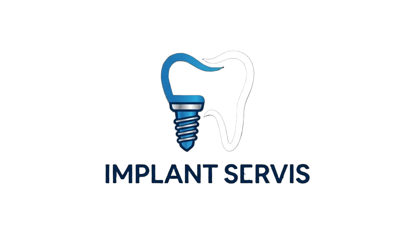 Implant Servis